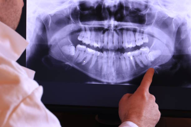 Best Emergency Dental Care for Broken or Chipped Teeth in Beech Mountain Lakes, PA